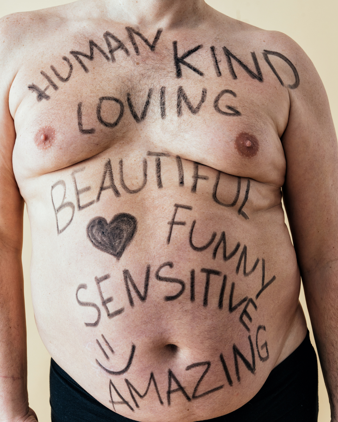 Being Overweight Is a Choice – And It’s Time to Stop Celebrating It